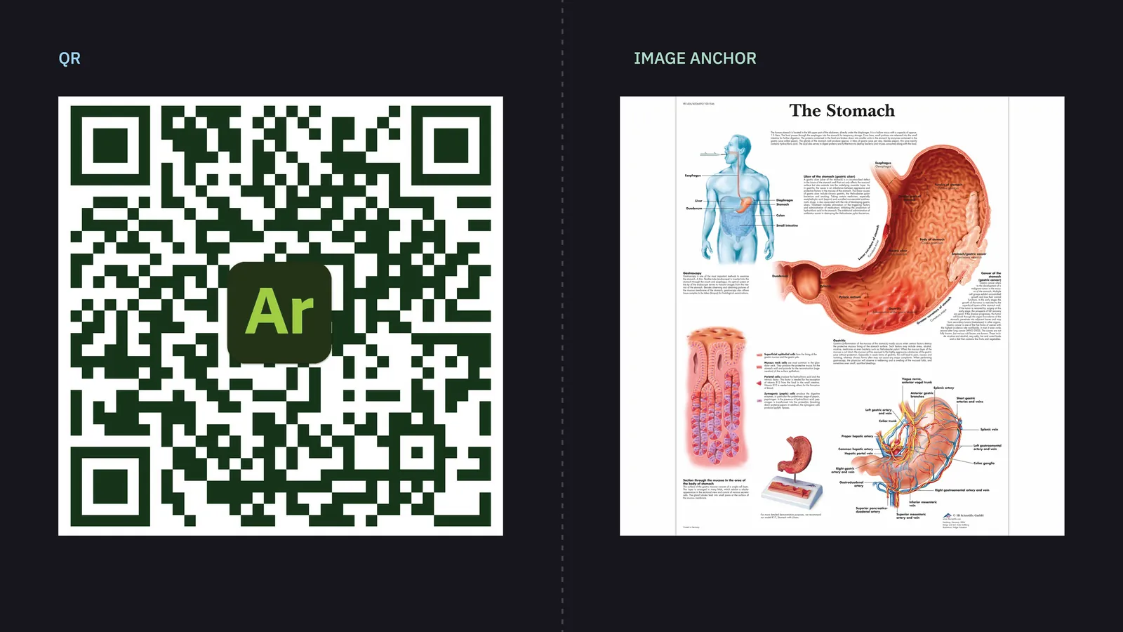 AR anatomy project: a QR code beside an anatomical illustration of the stomach used as an image anchor